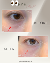Load image into Gallery viewer, Platelet-rich plasma (PRP) Treatment