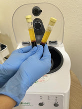 Load image into Gallery viewer, Platelet-rich plasma (PRP) Treatment