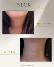 Load image into Gallery viewer, Belotero®: Neck Filler Treatment
