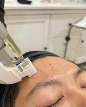 Load image into Gallery viewer, Platelet-rich plasma (PRP) Treatment
