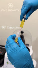 Load image into Gallery viewer, Platelet-rich plasma (PRP) Treatment