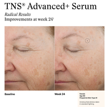 Load image into Gallery viewer, SkinMedica® TNS Advanced+ Serum
