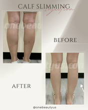 Load image into Gallery viewer, Toxin for Calf Slimming Treatment
