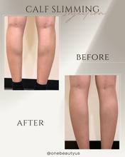 Load image into Gallery viewer, Toxin for Calf Slimming Treatment
