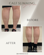 Load image into Gallery viewer, Toxin for Calf Slimming Treatment
