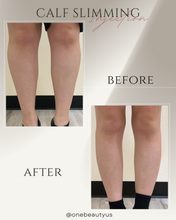Load image into Gallery viewer, Toxin for Calf Slimming Treatment
