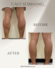 Load image into Gallery viewer, Toxin for Calf Slimming Treatment
