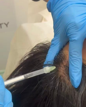 Load image into Gallery viewer, Platelet-rich plasma (PRP) Treatment
