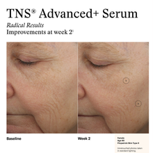 Load image into Gallery viewer, SkinMedica® TNS Advanced+ Serum
