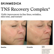 Load image into Gallery viewer, SkinMedica® TNS Recovery Complex®
