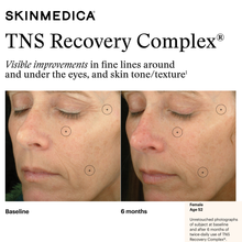Load image into Gallery viewer, SkinMedica® TNS Recovery Complex®
